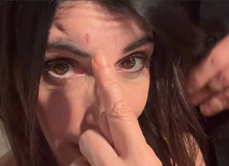 Giorgia indica la ferita sulla fronte